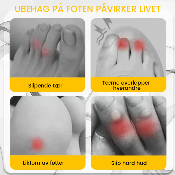 Silicone Tåbeskytter - Anti-friksjonskomfort | Transparent