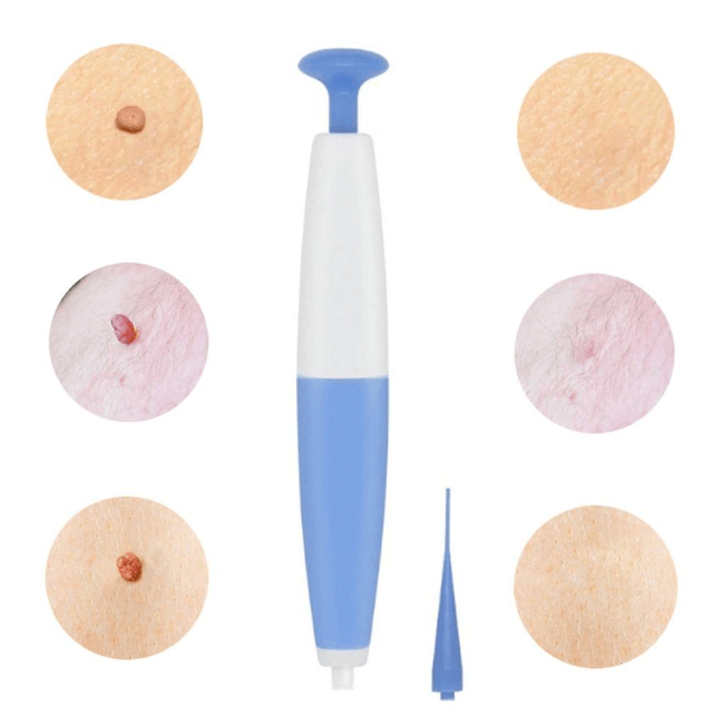 Skin Tag Remover Kit with 3.0 mm Remover for Home Use