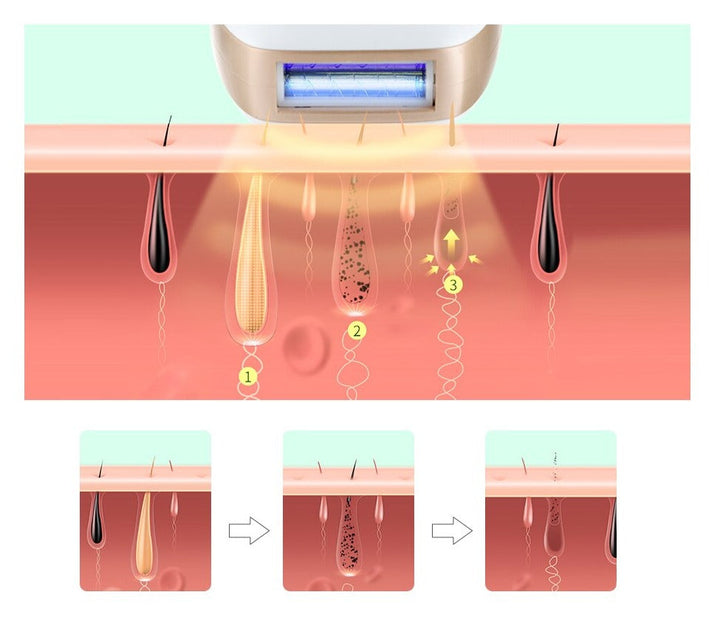 Ipl hårta bortr for long permanent smooth hide home