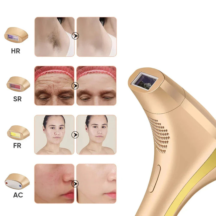 Unisex laser epila Tor for hårfjerning face and body